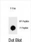 Phospho-BAD(S34) Antibody